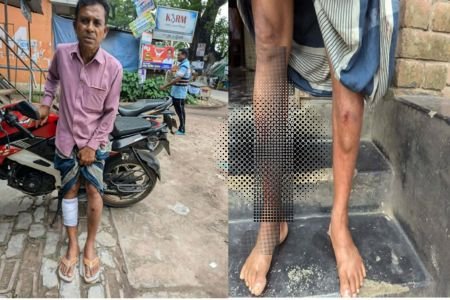 কালীগঞ্জে চাঁদা না পেয়ে সংখ্যালঘু সম্প্রদায়ের এক ব্যাক্তিকে কুপিয়ে জখম থানায় মামলা